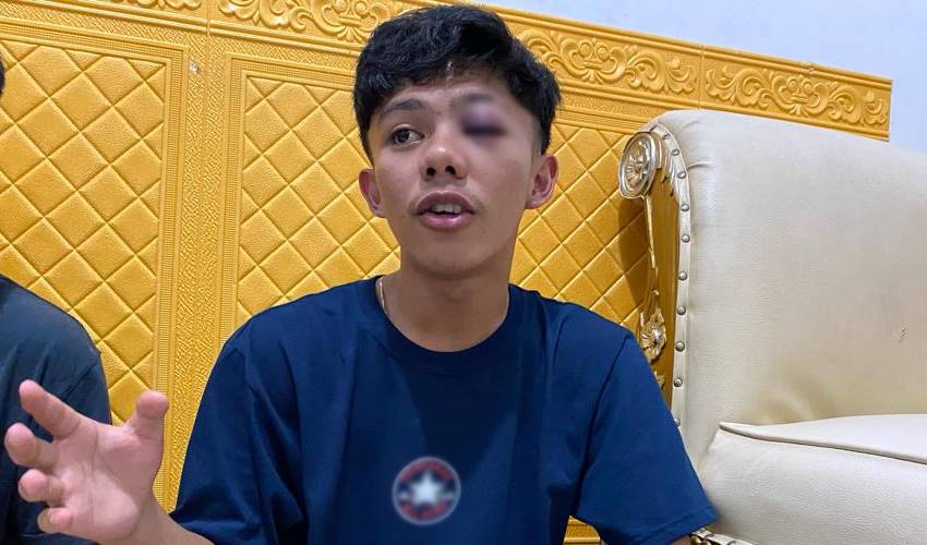 Oknum Polisi Diduga Aniaya Anak 17 Tahun dengan Senjata Api, Kapolda: Terbukti, Akan Ditindak Tegas
