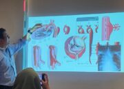 Kecepatan Menjadi Kunci Penyelamatan Nyawa pada Penanganan Penyakit Aorta Kompleks di Era Modern