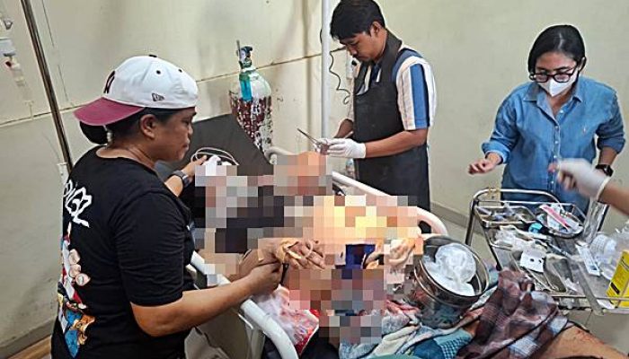 Cemburu dan Persoalan Nafkah Diduga Picu Suami Tusuk Istri hingga 15 Luka di Jalan Kasuari